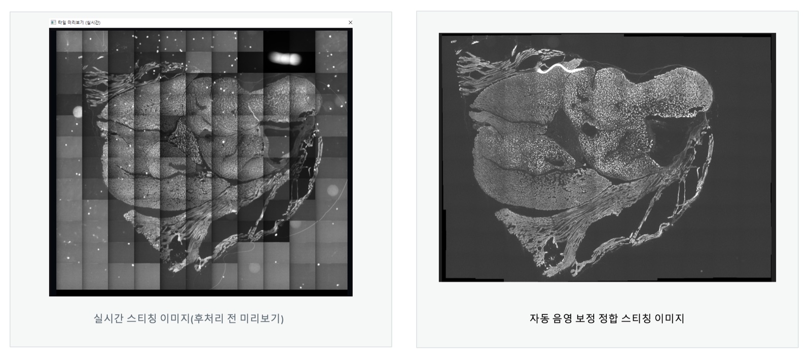 형광 촬영에서는 차이가 더 큽니다